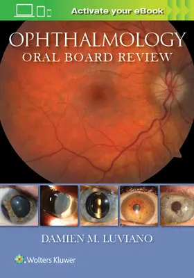 Revisione della commissione orale di oftalmologia - Ophthalmology Oral Board Review