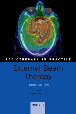 Terapia a fasci esterni - External Beam Therapy