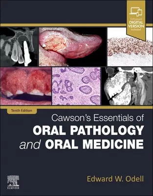 Elementi essenziali di patologia orale e medicina orale di Cawson - Cawson's Essentials of Oral Pathology and Oral Medicine