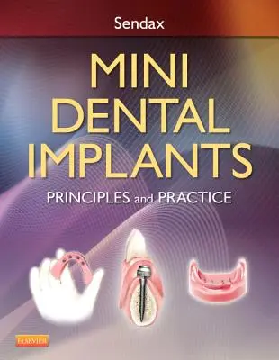 Mini impianti dentali: Principi e pratica - Mini Dental Implants: Principles and Practice