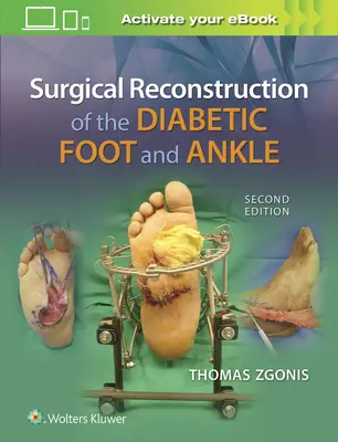Ricostruzione chirurgica del piede e della caviglia diabetici - Surgical Reconstruction of the Diabetic Foot and Ankle