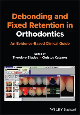Debonding e ritenzione fissa in ortodonzia: Una guida clinica basata sull'evidenza - Debonding and Fixed Retention in Orthodontics: An Evidence-Based Clinical Guide